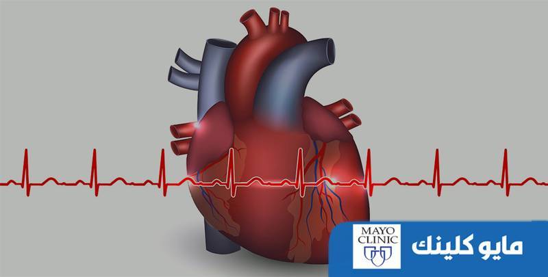 تعرف على أسباب وأعراض الإصابة بمتلازمة «دريسلر»